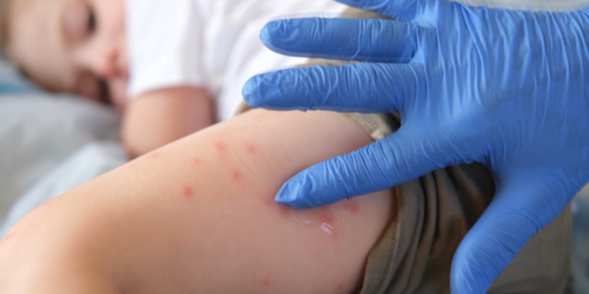 VDH urges vaccination for travelers flying abroad after possible exposure at D.C. airport