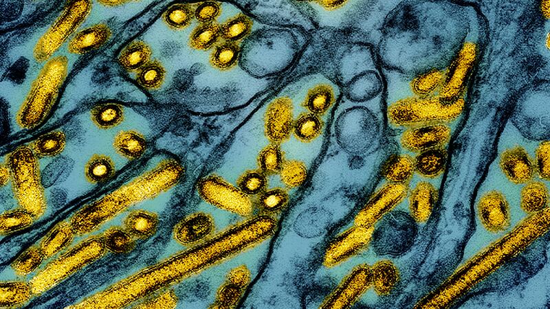 FILE -This colorized electron microscope image released by the National Institute of Allergy...