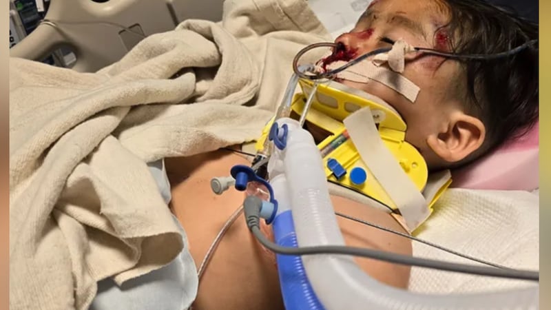 5-year-old declared brain dead after suspected DUI driver hits